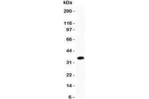 Western blot testing of Cofilin antibody and recombinant human protein (0. (Cofilin anticorps  (AA 2-166))