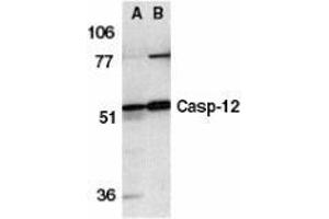 Western blot analysis of caspase-12 in human (A) and mouse (B) spleen tissue lysates with AP30190PU-N caspase-12 antibody at 1 μg/ml. (Caspase 12 anticorps  (N-Term))