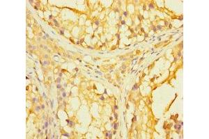 Immunohistochemistry of paraffin-embedded human testis tissue using ABIN7166699 at dilution of 1:100 (PAGE2B anticorps  (AA 1-111))