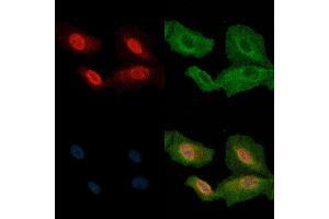 ABIN6263105 and ABIN6272810 staining  cells(H2O2 treatment) by IF/ICC. (MAP3K2 anticorps  (C-Term))