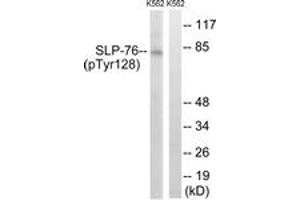 Western blot analysis of extracts from K562 cells treated with Na3VO4 0. (LCP2 anticorps  (pTyr128))