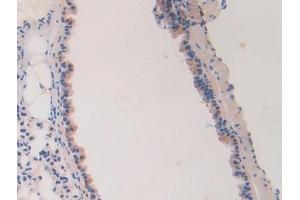 Detection of LAMa4 in Mouse Lung Tissue using Polyclonal Antibody to Laminin Alpha 4 (LAMa4)
