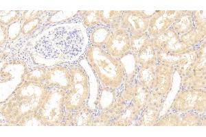 Detection of VEGFB in Human Kidney Tissue using Polyclonal Antibody to Vascular Endothelial Growth Factor B (VEGFB)