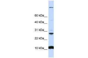 WB Suggested Anti-C19orf56 Antibody Titration:  0. (C19orf56 anticorps  (N-Term))