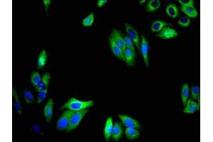 Immunofluorescent analysis of HepG2 cells using ABIN7173245 at dilution of 1:100 and Alexa Fluor 488-congugated AffiniPure Goat Anti-Rabbit IgG(H+L)