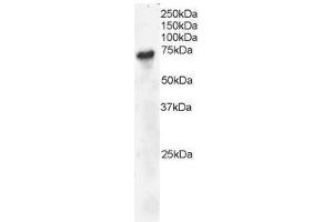 Image no. 2 for anti-B-Cell Linker (BLNK) (C-Term) antibody (ABIN374092) (B-Cell Linker anticorps  (C-Term))