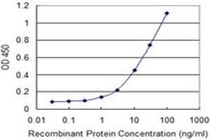 Detection limit for recombinant GST tagged MBD1 is 0. (MBD1 anticorps  (AA 415-508))