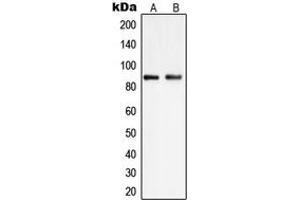 Western blot analysis of PIP5K1C expression in HEK293 (A), K562 (B) whole cell lysates. (PIP5K1C anticorps  (Center))