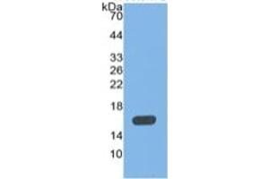 WB of Protein Standard: different control antibodies  against Highly purified E. (MBL2 Kit ELISA)