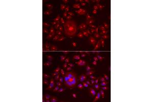 Immunofluorescence analysis of A549 cell using GORASP1 antibody. (GORASP1 anticorps)