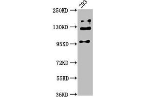 Western Blot Positive WB detected in: 293 whole cell lysate All lanes: RAB3GAP2 antibody at 5 μg/mL Secondary Goat polyclonal to rabbit IgG at 1/50000 dilution Predicted band size: 156, 24 kDa Observed band size: 110, 130, 150 kDa (RAB3GAP2 anticorps  (Catalytic Subunit))