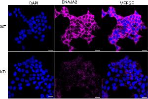 Immunocytochemical staining of HeLa cells using DNAJA2 antibody (ABIN7798371), 1:1,000), Top panel: wild-type (WT), Bottom panal: DNAJA2 shRNA knockdown (KD).