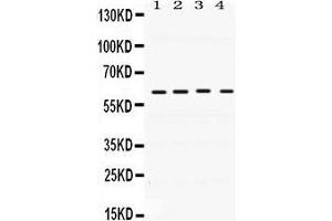 Western Blotting (WB) image for anti-BCL2-Associated Athanogene 3 (BAG3) (AA 100-561) antibody (ABIN3042341) (BAG3 anticorps  (AA 100-561))