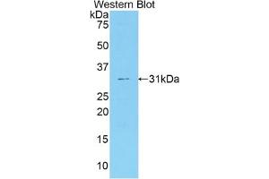 Detection of Recombinant F5, Mouse using Polyclonal Antibody to Coagulation Factor V (F5)