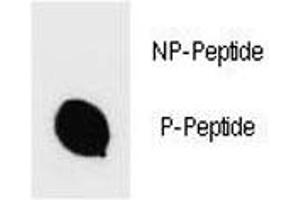 Dot blot analysis of phospho-IKK beta antibody.