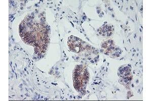 Immunohistochemistry (IHC) image for anti-Myeloid Leukemia Factor 1 (MLF1) antibody (ABIN1499498) (MLF1 anticorps)