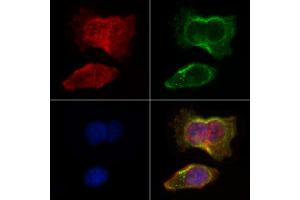 ABIN6264652 and ABIN6266628 staining HepG2 by IF/ICC. (RASH/RASK/RASN (N-Term) anticorps)