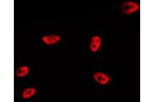 ABIN6267287 staining MDA-MB-435 by IF/ICC.