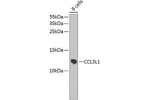 Western blot analysis of extracts of B-cell cells, using CCL3L1 antibody (ABIN3016836, ABIN3016837, ABIN3016838 and ABIN6219853) at 1:1000 dilution. (CCL3L1 anticorps  (AA 24-93))