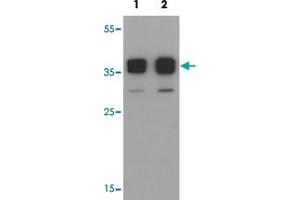 Western blot analysis of TSPY1 in A-20 cell lysate with TSPY1 polyclonal antibody  at (1) 0. (TSPY1 anticorps  (C-Term))