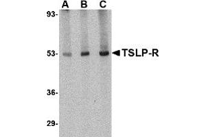 Western Blotting (WB) image for anti-Cytokine Receptor-Like Factor 2 (CRLF2) (Middle Region) antibody (ABIN1031149) (CRLF2 anticorps  (Middle Region))