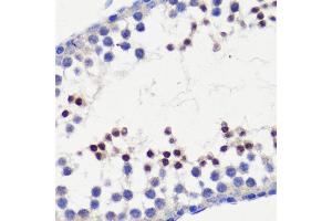 Immunohistochemistry of paraffin-embedded mouse testis using HFM1 antibody (ABIN6133318, ABIN6141741, ABIN6141743 and ABIN6224711) at dilution of 1:100 (40x lens). (HFM1 anticorps  (AA 1-240))
