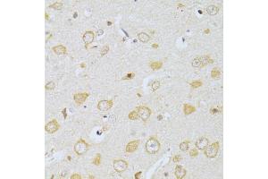 Immunohistochemistry of paraffin-embedded rat brain using CHRNA7 antibody. (CHRNA7 anticorps)