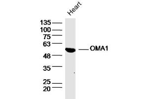Rat heart lysates probed with OMA1 Polyclonal Antibody, Unconjugated  at 1:300 dilution and 4˚C overnight incubation. (OMA1 anticorps  (AA 401-500))