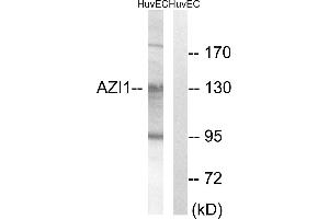 Immunohistochemistry analysis of paraffin-embedded human breast carcinoma tissue using AZI1 antibody. (AZI1 anticorps)