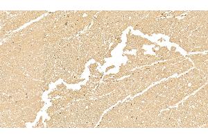 Detection of CK18 in Human Cerebrum Tissue using Monoclonal Antibody to Cytokeratin 18 (CK18)