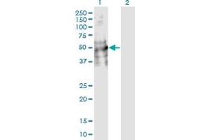 Western Blot analysis of DDC expression in transfected 293T cell line by DDC monoclonal antibody (M18), clone 8E8.