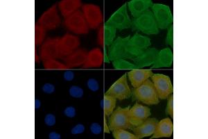 ABIN7095250 and ABIN7099307 staining Hela cells(30 min of UV treatment) by IF/ICC.