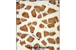 Formalin-fixed and paraffin-embedded human skeletal muscle reacted with TBC1D4 Antibody (N-term), which was peroxidase-conjugated to the secondary antibody, followed by DAB staining. (TBC1D4 anticorps  (N-Term))
