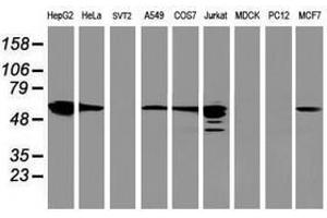 Image no. 4 for anti-Farnesyl-Diphosphate Farnesyltransferase 1 (FDFT1) antibody (ABIN1498243)