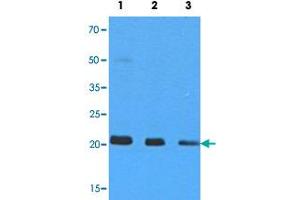 Western blot analysis of 293T cell extracts (35 ug) with NRAS monoclonal antibody, clone AT2G9  at 1:500 (Lane 1), 1:1000 (Lane 2) and 1:5000 (Lane 3) dilution. (GTPase NRas anticorps)
