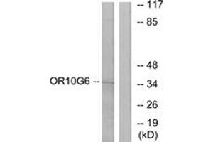 Western blot analysis of extracts from COLO cells, using OR10G6 Antibody. (OR10G6 anticorps  (AA 261-310))
