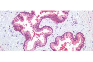 Detection of TGFb3 in Human Prostate Tissue using Polyclonal Antibody to Transforming Growth Factor Beta 3 (TGFb3) (TGFB3 anticorps  (AA 24-300))