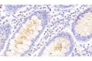 Detection of PLIN4 in Human Colon Tissue using Polyclonal Antibody to Perilipin 4 (PLIN4)