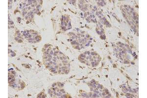 Immunohistochemistry (IHC) image for anti-Proteasome (Prosome, Macropain) 26S Subunit, Non-ATPase, 2 (PSMD2) antibody (ABIN1874389) (PSMD2 anticorps)