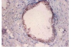 Immunohistochemistry of paraffin-embedded human prostate tissue using ABIN7159368 at dilution of 1:100 (PKMYT1 anticorps  (AA 900-1101))