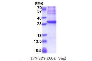 SDS-PAGE (SDS) image for Glutamate Decarboxylase 1 (Brain, 67kDa) (GAD1) (AA 1-224) protein (His tag) (ABIN5853654)