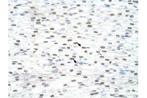 anti-LSM2 Homolog, U6 Small Nuclear RNA Associated (LSM2) antibody