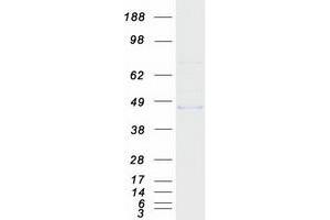 Validation with Western Blot