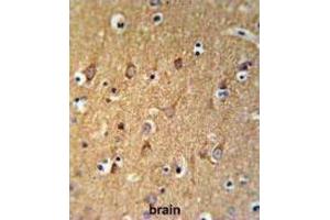 Immunohistochemistry (IHC) image for anti-Sphingomyelin Synthase 2 (SGMS2) antibody (ABIN3004329)