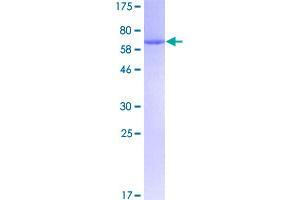 Image no. 2 for Casein Kinase 2, alpha Prime Polypeptide (CSNK2A2) (AA 1-350) protein (GST tag) (ABIN1350553)