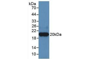 Detection of Recombinant HPA, Human using Monoclonal Antibody to Heparanase (HPSE)