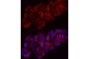 Immunofluorescence analysis of HeLa cells using Heme Oxygenase 1 (HO-1/HMOX1) antibody (ABIN3021906, ABIN3021907, ABIN3021908 and ABIN6217466) at dilution of 1:100 (40x lens).