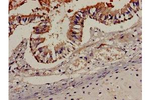 Immunohistochemistry analysis of human lung tissue using ABIN7145942 at dilution of 1:100 (CCR7 anticorps  (AA 332-378))