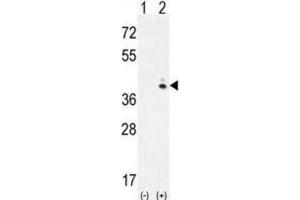 Western Blotting (WB) image for anti-Galactokinase 1 (GALK1) antibody (ABIN3002977) (GALK1 anticorps)
