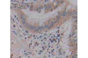 Figure. (MUC17 anticorps  (AA 3773-3998))